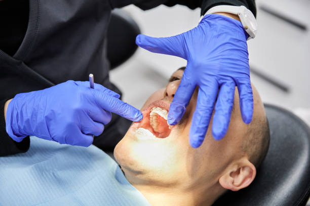 Best Emergency Dentist for Knocked-Out Tooth in St Matthews, KY